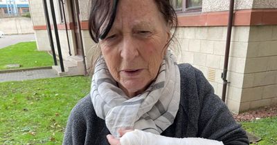 Edinburgh woman falls into busy road and warns others of ‘dangerous’ crossing