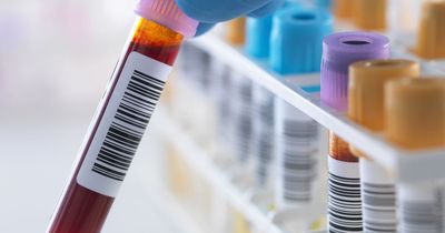 I tried to get a HIV test and this is how easy it is