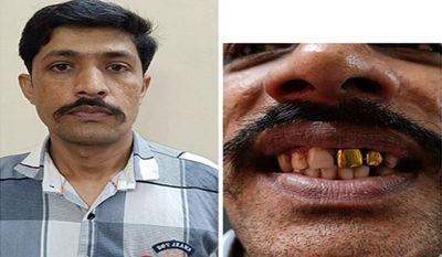 Mumbai: Police Arrests Fugitive On Run For 15 Years; Identify Him From His Gold Teeth