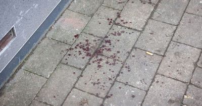 Man stabbed in neck outside pub after row with two 'balaclava clad men'