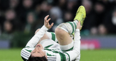 Kyogo Furuhashi sparks Celtic injury concern as Japanese forward forced off amid cup final fear