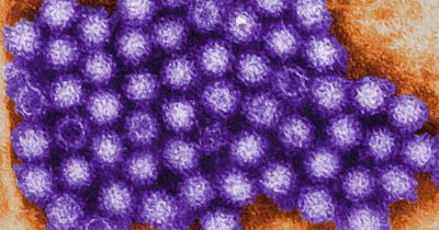 Is Norovirus contagious and how long does the 'winter vomiting bug' last?