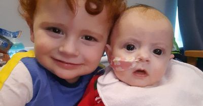 Two-year-old boy to be donor for transplant to save baby sister's life