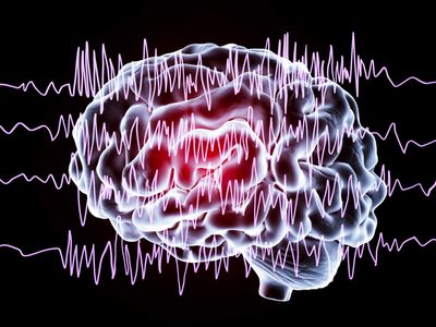 Lasers, robots, and tiny electrodes are transforming treatment of severe epilepsy
