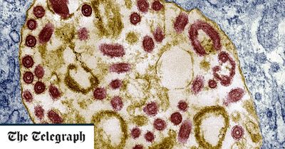 Equatorial Guinea confirms Marburg outbreak – nine dead, 4,000 in quarantine