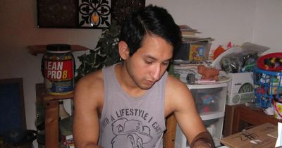 Man who was afraid to speak to women now fighting them off after £20,000 surgery