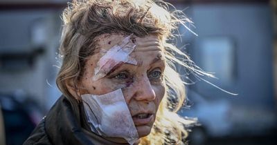 ‘Face of war’ Ukrainian woman pictured one year on as she wants to help homeland