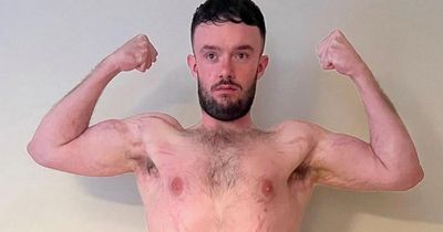 Man inspired by Corrie lost 100lbs and almost cures his psoriasis