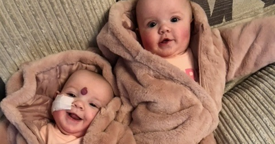 Mum who turned down abortion of twin daughter celebrates tot’s remarkable recovery