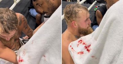 Jake Paul left bloodied as YouTube star finishes training for Tommy Fury fight