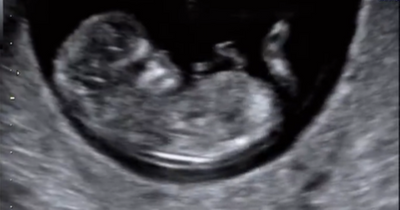 Love Island's Laura Anderson delights fans after sharing sweet baby scan video on Instagram