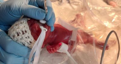Joy as miracle Manchester twins born at just 22 WEEKS to come home