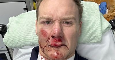 Dan Walker 'glad to be alive' after car smashes into him while riding his bike