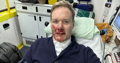 Dan Walker 'glad to be alive' after his bike was hit by a car