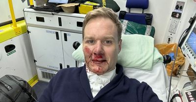 TV presenter Dan Walker 'glad to be alive' after being hit by car while riding bike