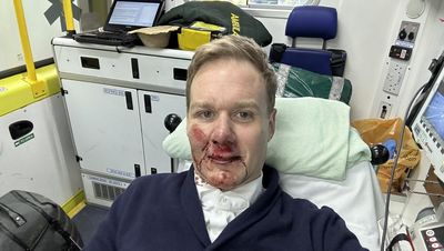 TV presenter Dan Walker ‘glad to be alive’ after being hit by a car while cycling