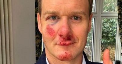 "I have no memory of anything" - Dan Walker returns home from horror accident