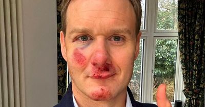 Dan Walker is constantly on verge of tears and unable to sleep after horror bike crash