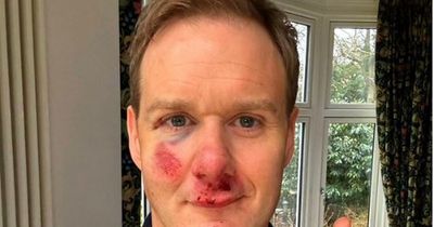 Channel 5's Dan Walker knocked 'out cold' by horrifying cycling crash as he issues Twitter update