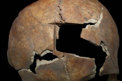 Clues to Bronze Age cranial surgery revealed in ancient bones