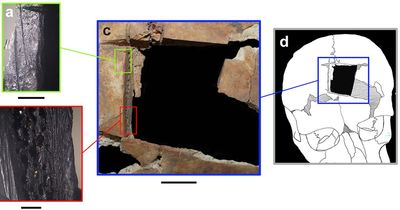 Scientists discover evidence of 3,500-year-old BRAIN SURGERY conducted on two brothers