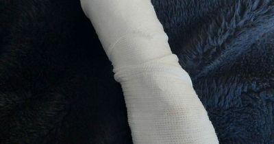 Woman suffers broken arm after large Alsatian pounces on her on Scots road