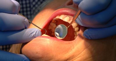 More than 25,000 children in England had decaying teeth removed in hospital