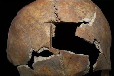 Bronze Age grave reveals man had brain surgery 3,000 years ago