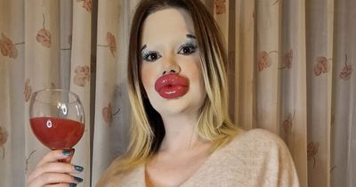 Woman with 'world's biggest lips' is now splashing out on her cheekbones