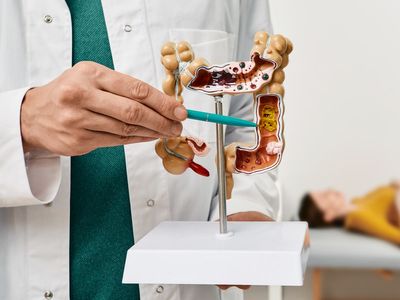 NHS urges people to use bowel cancer home testing kit: ‘Don’t put it off’