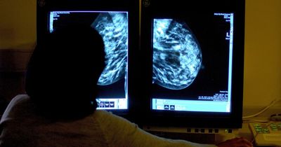 The bleak picture of how bad cancer waiting times are in Wales