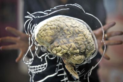Experts identify link between head injuries and brain tumours