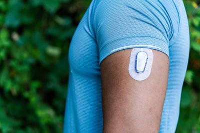 Continuous glucose monitors are trendy wearables—but how useful are they? Here's what experts say