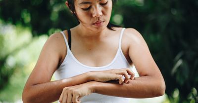 Signs and symptoms of scabies and how to get rid of them