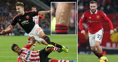 Luke Shaw's leg scar as he prepares to complete greatest ever Man Utd comeback