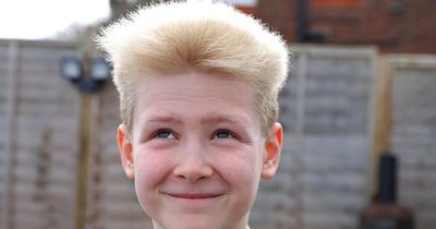 Boy, aged 10, gets stopped in the street due to his 'weird and wiry' hair caused by rare condition