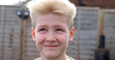 Boy, 10, with uncombable hair due to rare condition 'gawked' at in street by strangers