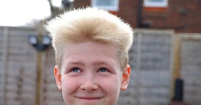 Boy,10, gets asked in the street about his unique hair caused by rare condition