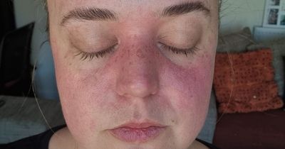 Woman's rare condition causes her eyes to 'switch off' while driving on motorway