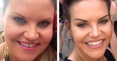 Mum spends £32k on excess skin removal after 11st weight loss following cruel insults