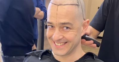 Inside Lee Mead's gruelling 7-hour hair transplant - Turkey procedure to total cost