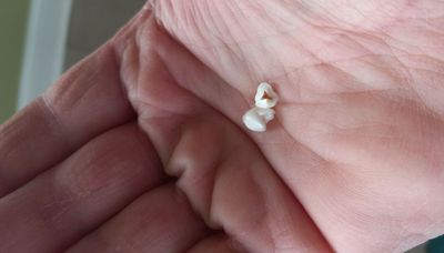 Eggs, gas and now the Tooth Fairy?