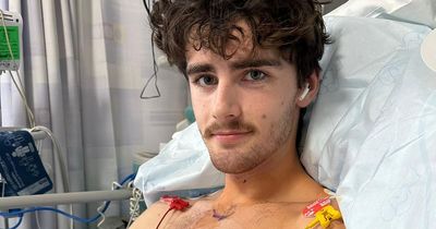 Horror Leeds night out left teen with brain damage after his heart stopped
