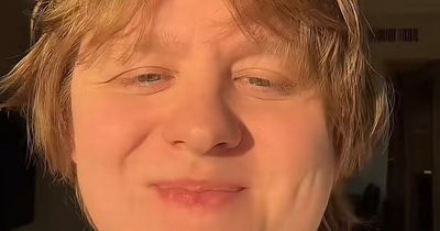 Lewis Capaldi leave fans in stitches with hilarious Harry Potter doppelgänger