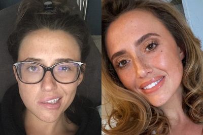 Woman left unable to smile after waking up paralysed