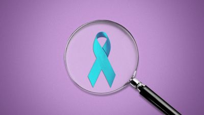 Colorectal cancer getting diagnosed later, among younger people: study