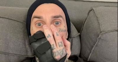 Blink-182 forced to postpone start of reunion tour after Travis Barker's finger injury