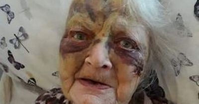Grieving family search for answers after gran suffered serious facial injuries at care home