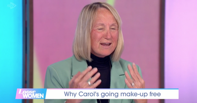 Loose Women's Carol McGiffin denies cosmetic surgery after her face is 'like a tomato'
