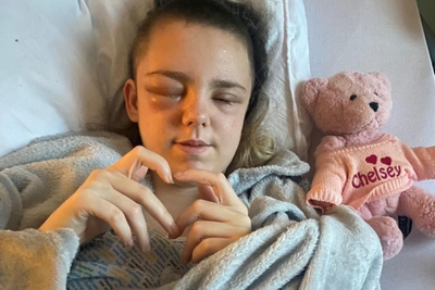 Girl thanks medics after life-saving surgery saw part of skull stored in stomach